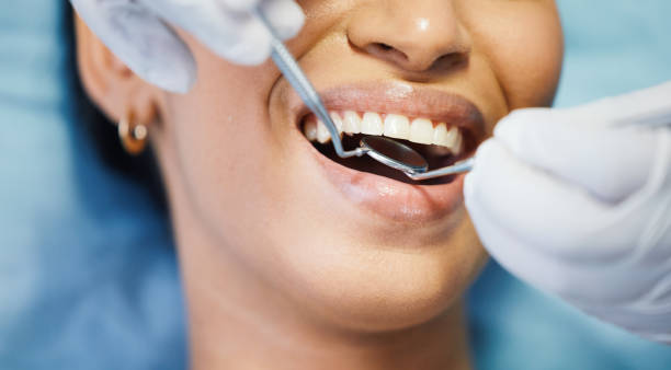 Best Chipped Tooth Repair Near Me  in Manche North Shore, CA